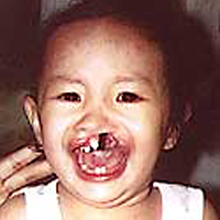 Alia vorher, Operation Restore Hope