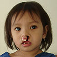 Christal vorher, Operation Restore Hope